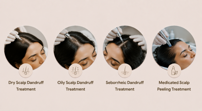 Dandruff Scalp Treatment